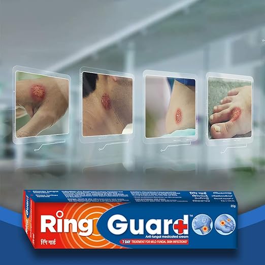 Ring Guard Anti Fungal Medicated Cream 20 gm