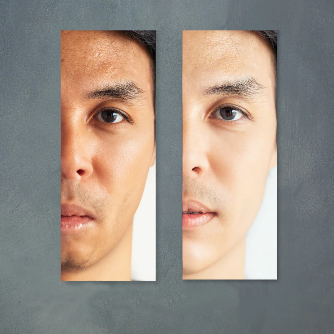 Belo Men Whitening Bar Soap - 135g