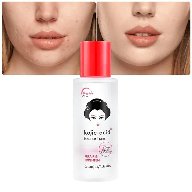Guanjing Beauty Kojic Acid Repair & Brighten Essence Toner - 100ml