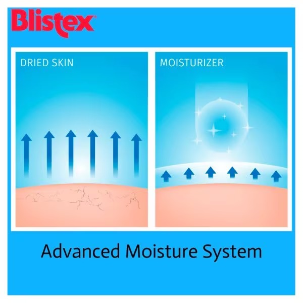 Blistex Intensive Lip Moisturiser SPF 10, 5g
