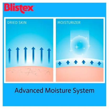 Blistex Intensive Lip Moisturiser SPF 10, 5g