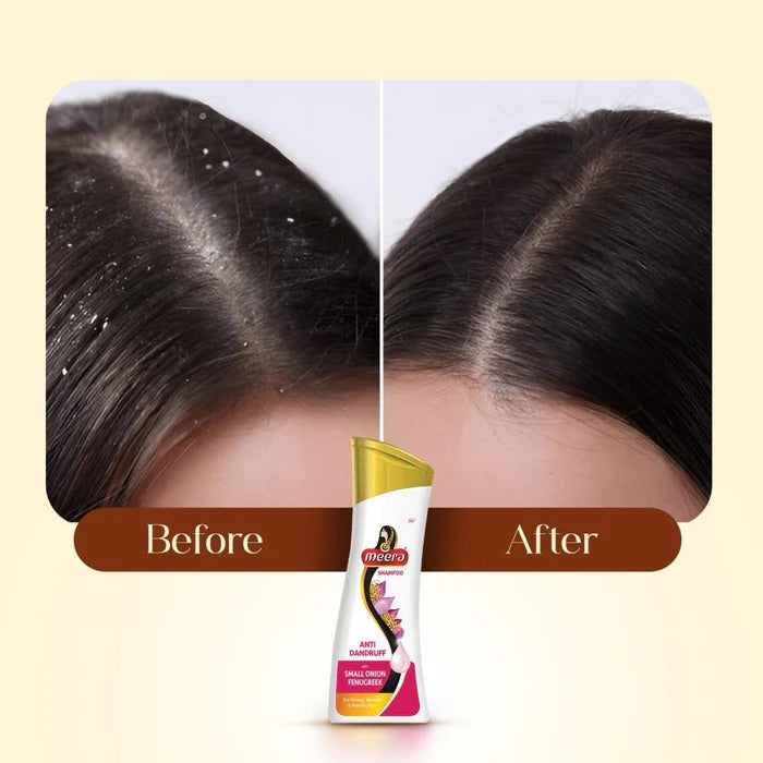 Meera Anti Dandruff Shampoo 180 ml